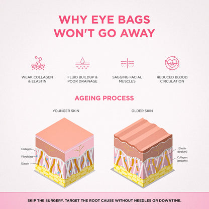 RevitalEyes® 2-in-1 Red Light Therapy + EMS To Erase Eye Bags